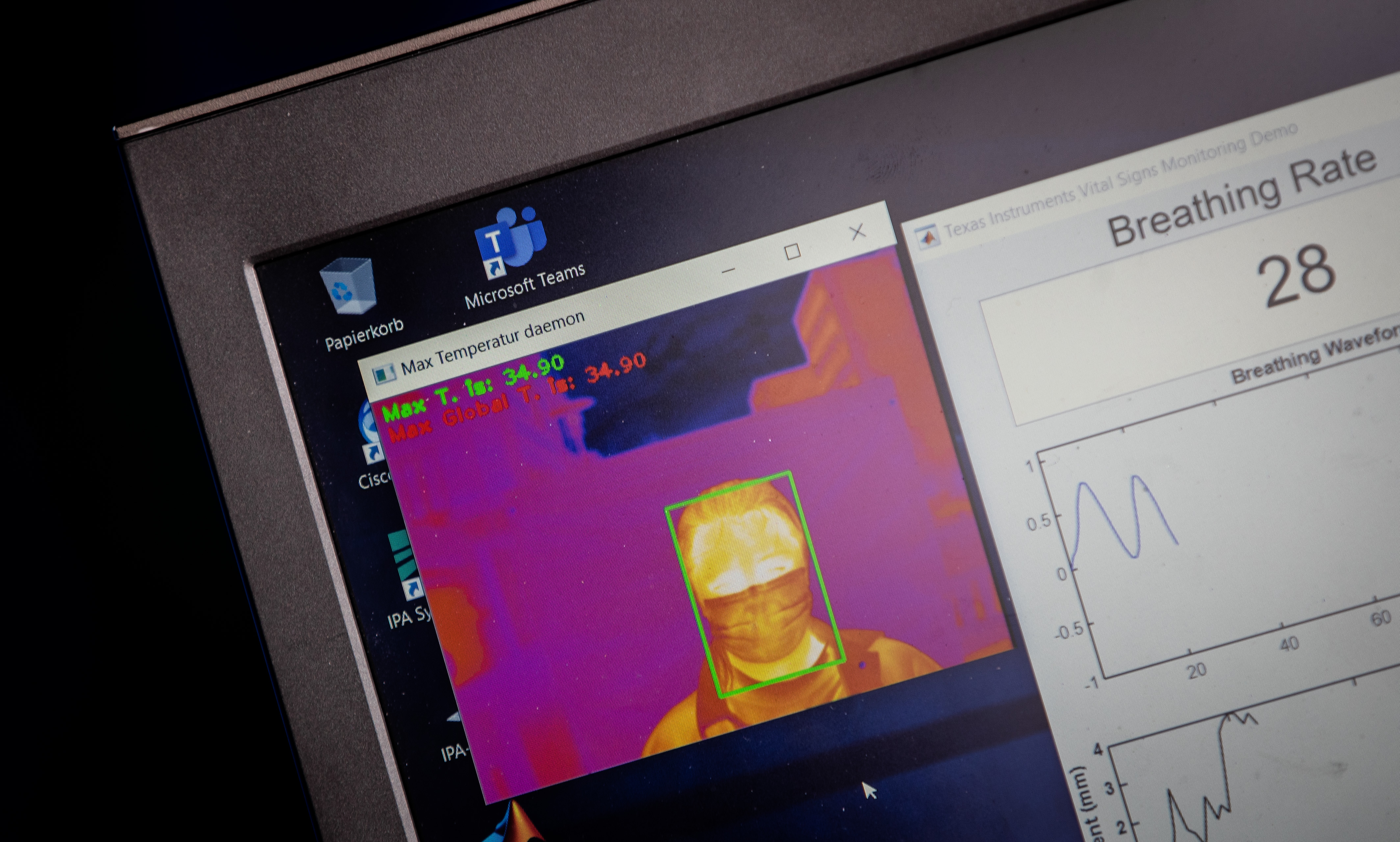 Bildausschnitt der Testauswertung mit Wärmebild des Gesichts und Atemhüben.